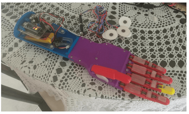 Prótesis de mano ensamblada con la electrónica dentro del socket